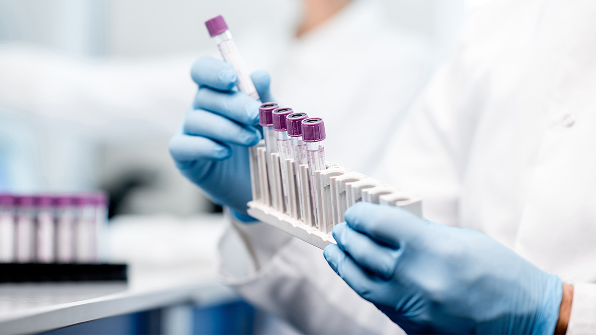 6---Companion-Diagnostics.jpg
